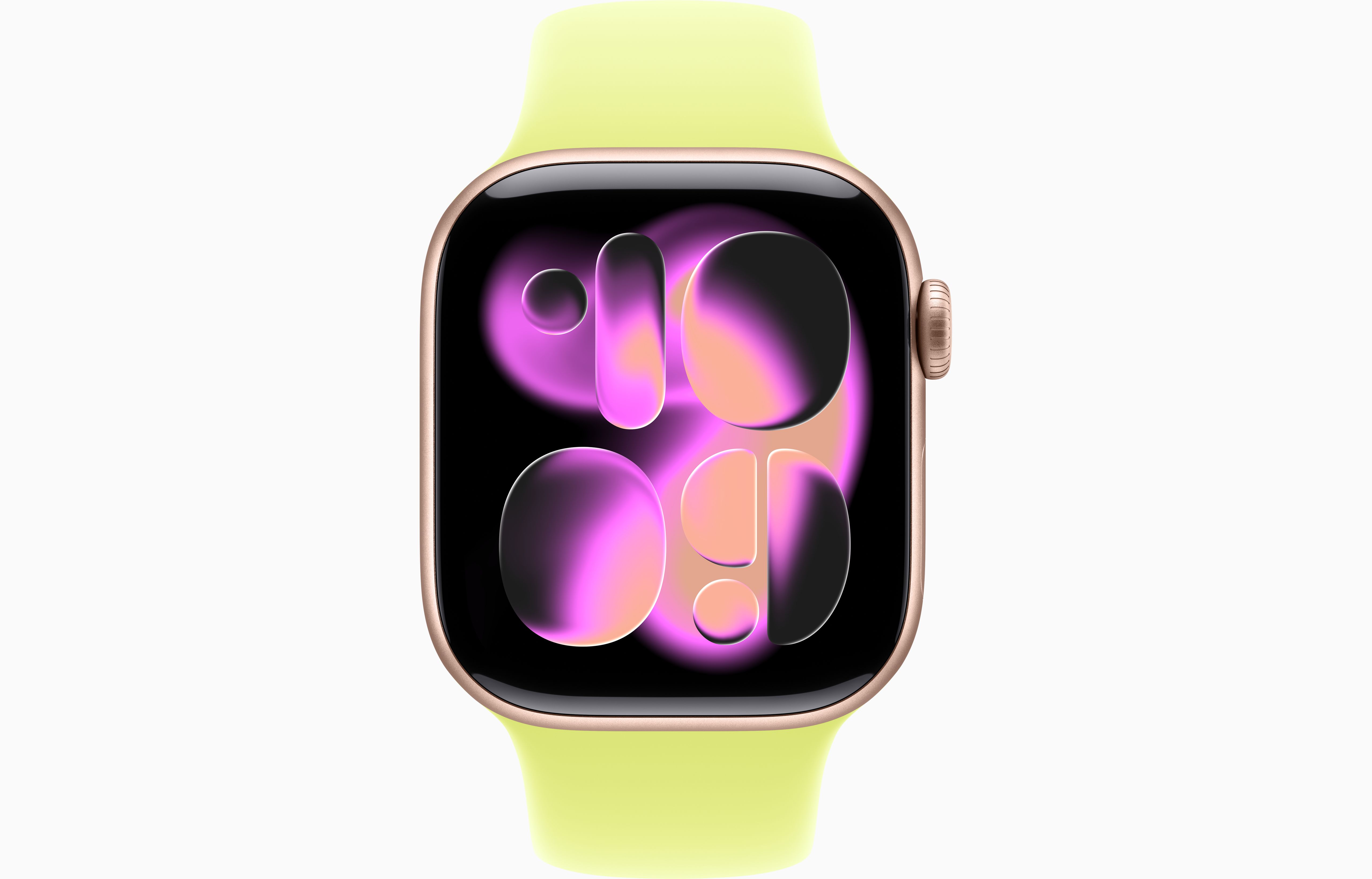 Apple Watch Series 11 Aluminum GPS – Rose Gold (Neon Yellow Sport Band) - Image 2