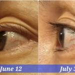 EYELASH AND EYEBROW MIRACLE GROWTH SERUM