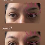 EYELASH AND EYEBROW MIRACLE GROWTH SERUM